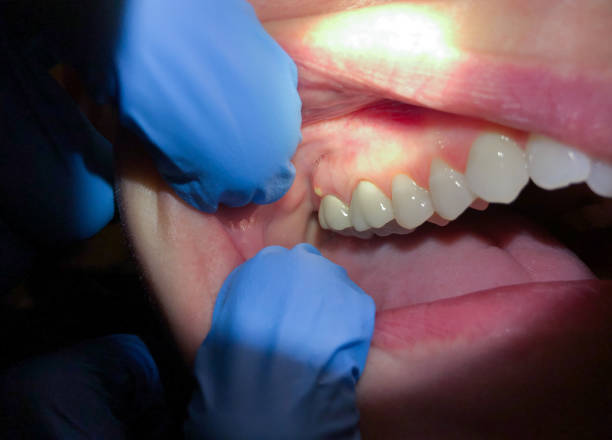 Best Emergency Treatment for Toothache in North Salt Lake, UT