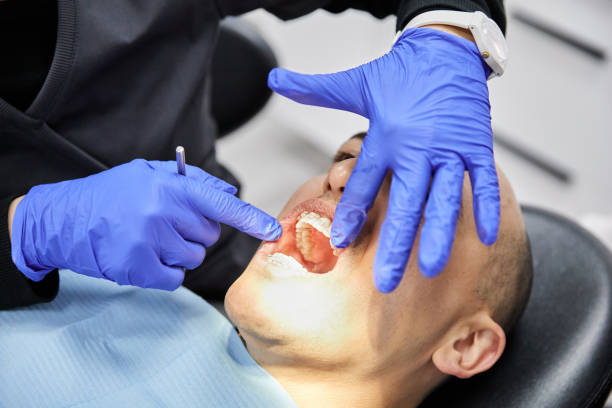 Best Emergency Treatment for Toothache in North Salt Lake, UT